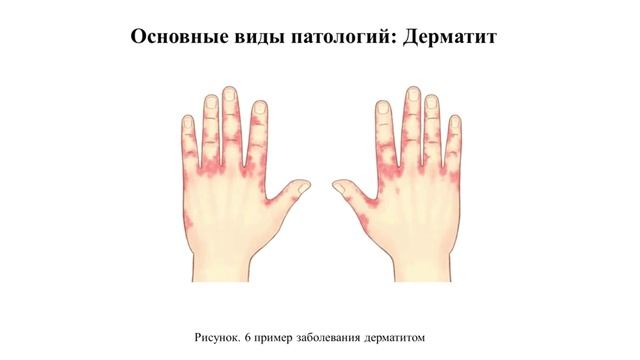 Видео Лекция по теме Кожа
