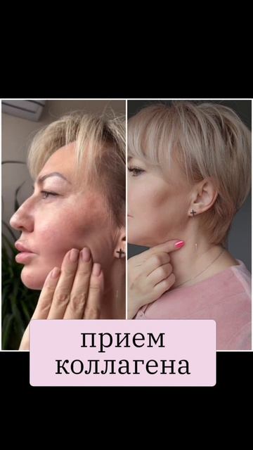 Коллаген пептидный