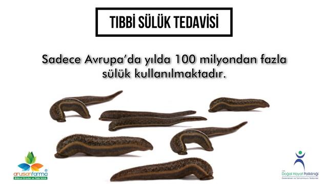 Tıbbi Sülük Tedavisi