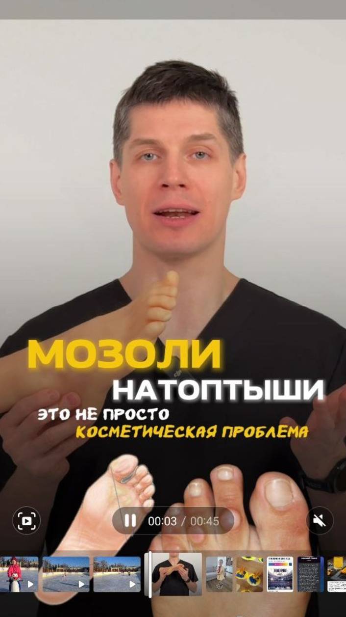 О чем говорят натоптыши на ногах?