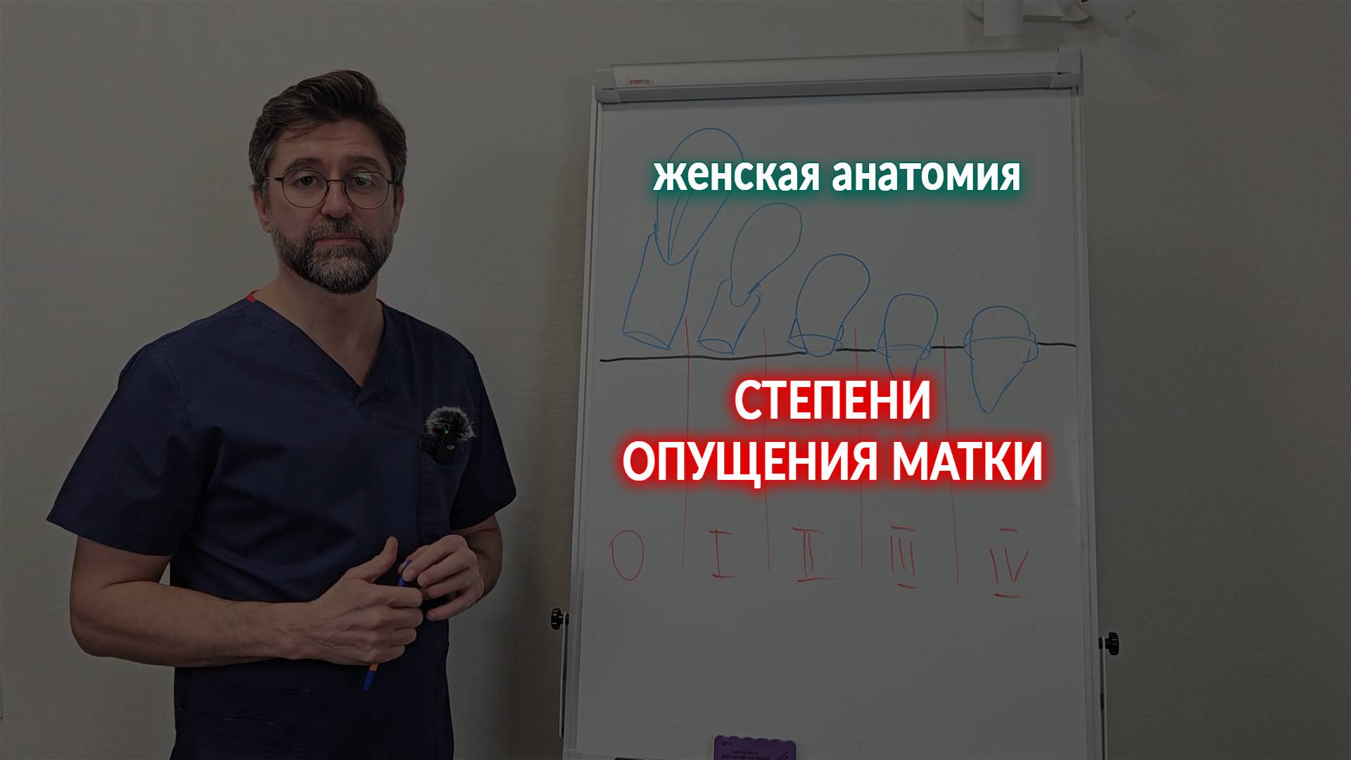 Степени опущения матки