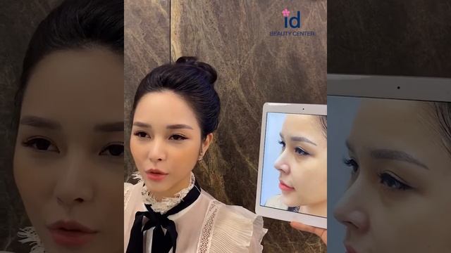 Phạm thanh Huyền trị thâm mắt | Meso eye tại id