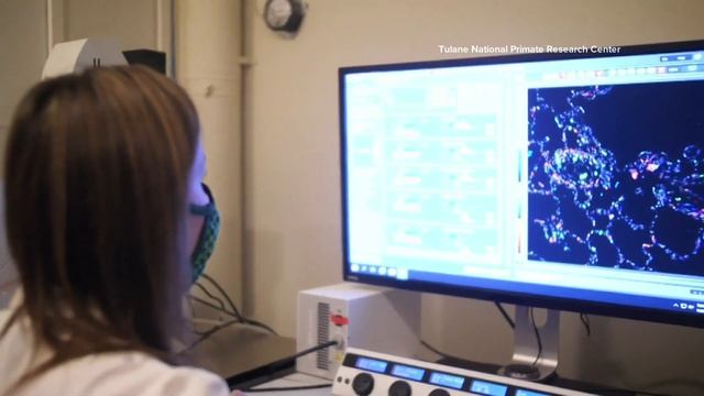 New study finds evidence of Lyme bacteria in brain tissue