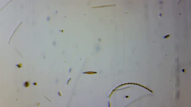 Клостериум в движении (Closterium)