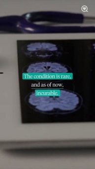 Céline Dion Cancels Shows After Being Diagnosed With Stiff Person Syndrome Part 2 #Sharecare #Shor