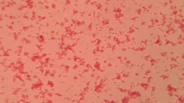 Salmonella in Gram stain