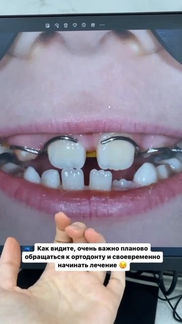 Эта пластинка — супергерой 🦸♂️.