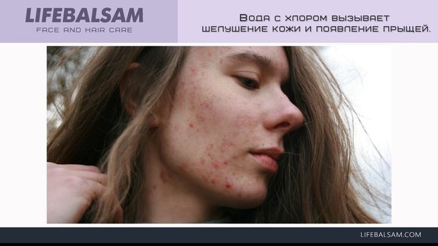 Вода с хлором вызывает шелушение и появление прыщей.