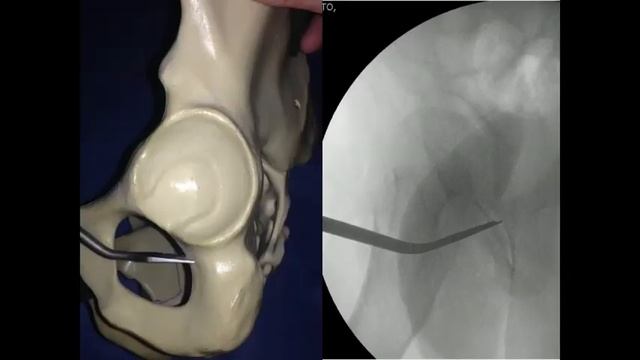 SAOTI 16 de agosto parte 1