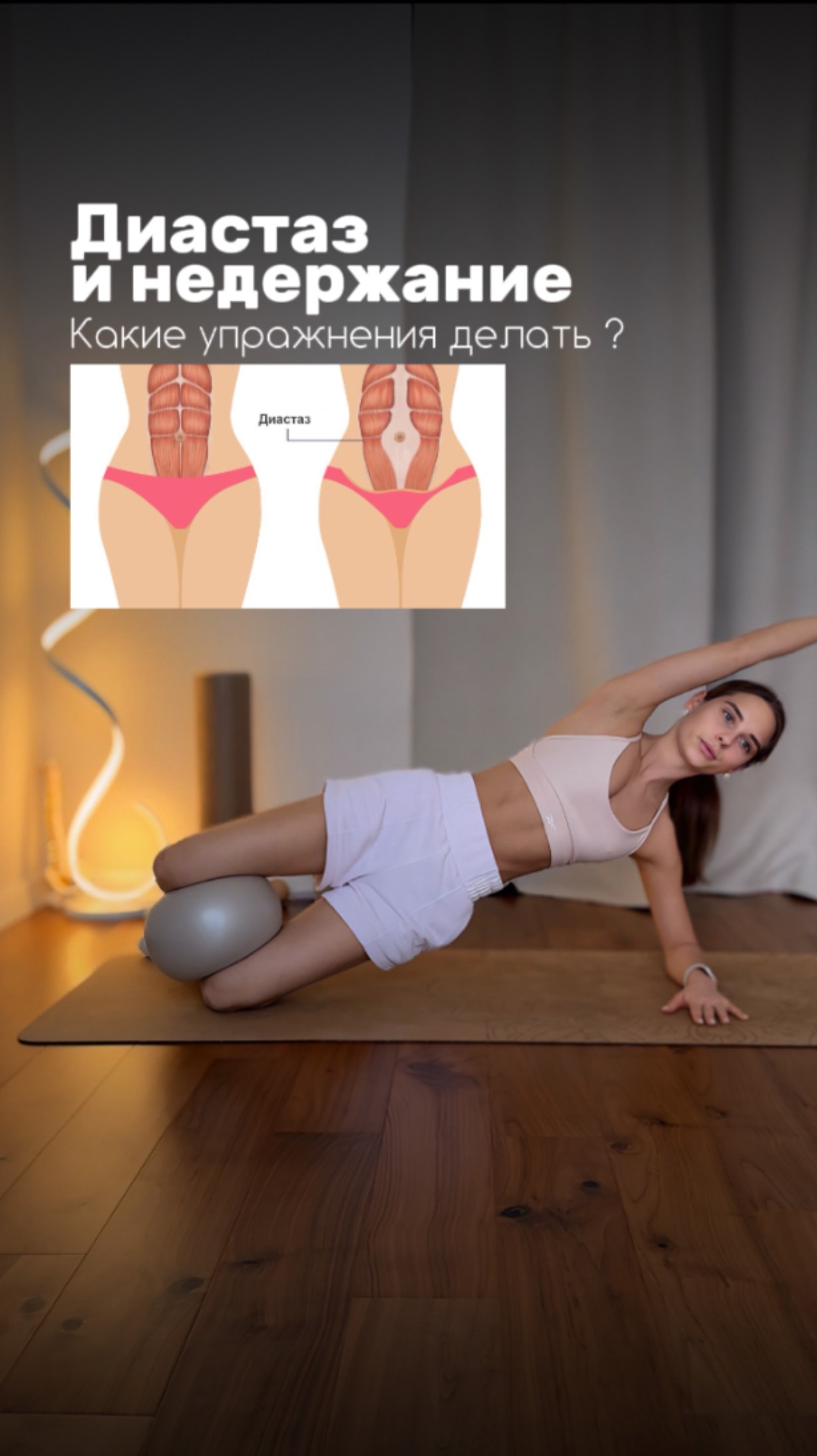 Диастаз и недержание