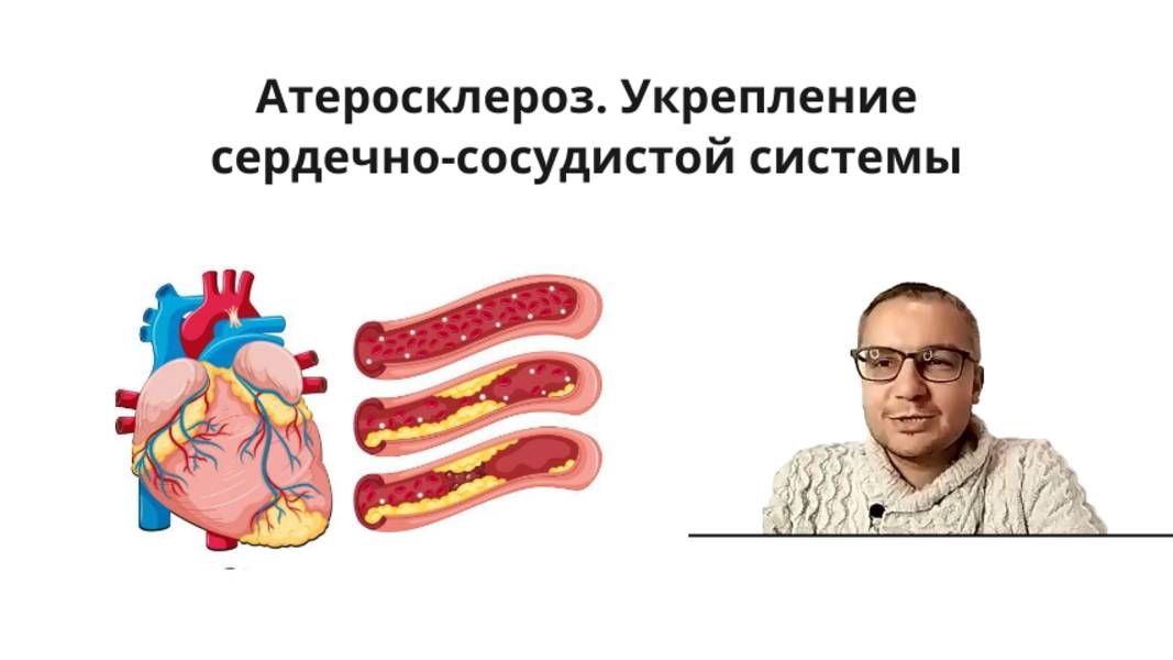 Атеросклероз. Причины и эффективные методы укрепления сердечно-сосудистой системы