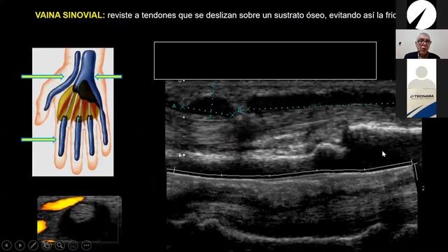 Como realizar ultrasonido de la mano.