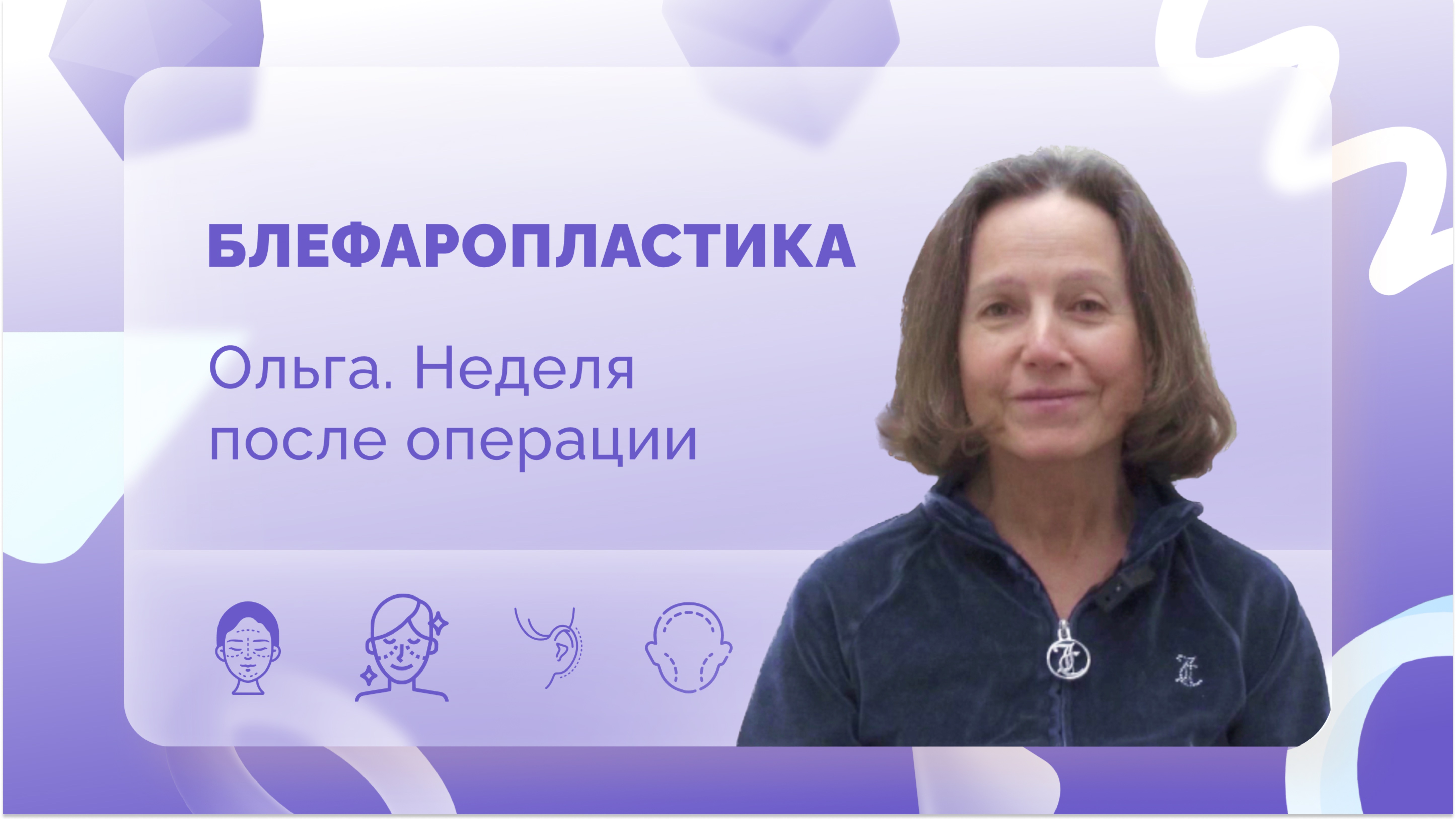 Ольга. Блефаропластика. Неделя после операции.