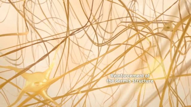 Gatuline® In-Tense MB: In-depth remodeling