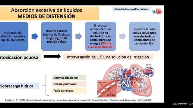 Complicaciones en histeroscopia - MAY 7