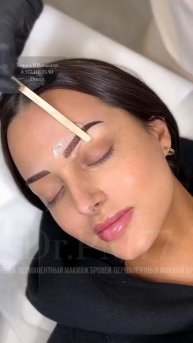 🎖Москва🎖Записаться👇🏽 📲Вотсапп 8.977.110.75.50 •В Instagram @dr.pm77 •В ТикТок @dr.pm77•#drpm77