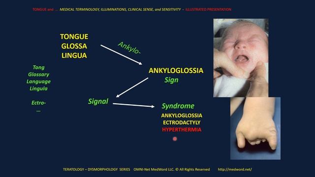 CLINICAL PRACTICUM HOW TO - FROM TONGUE to DIAGNOSIS - MACROGLOSSIA - CANCER - EPIGENETICS