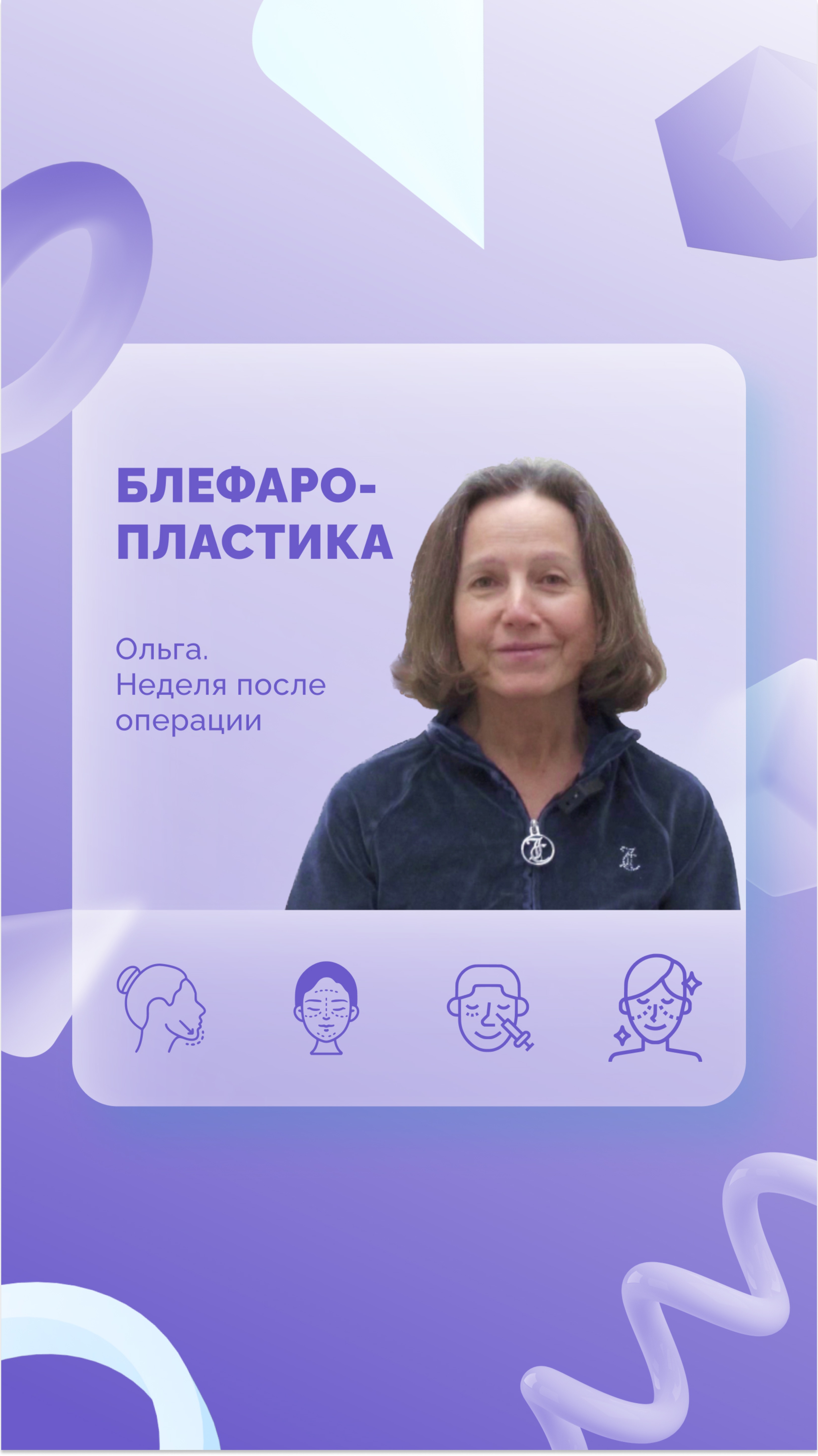 Ольга. Блефаропластика. Неделя после операции.