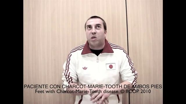 PIES CON CHARCOT.MARIE.TOOTH.mov