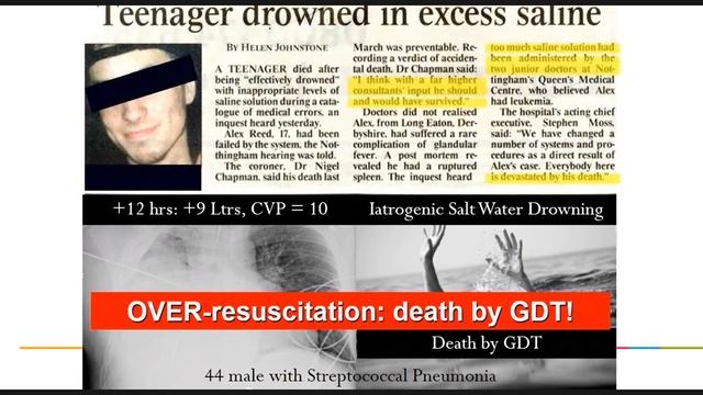 Shock with intra abdominal hypertension Manu Malbrain 2017