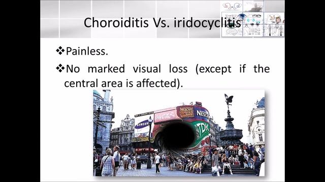 Elbromboly Basic ophthalmology IC Uvea Choroditis