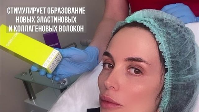 Биоревитализация препаратом Belotero Hydro в клинике "Артевита"