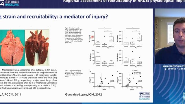 Regional assessment of recruitability in ARDS physiological implications Luca Salvatore Menga