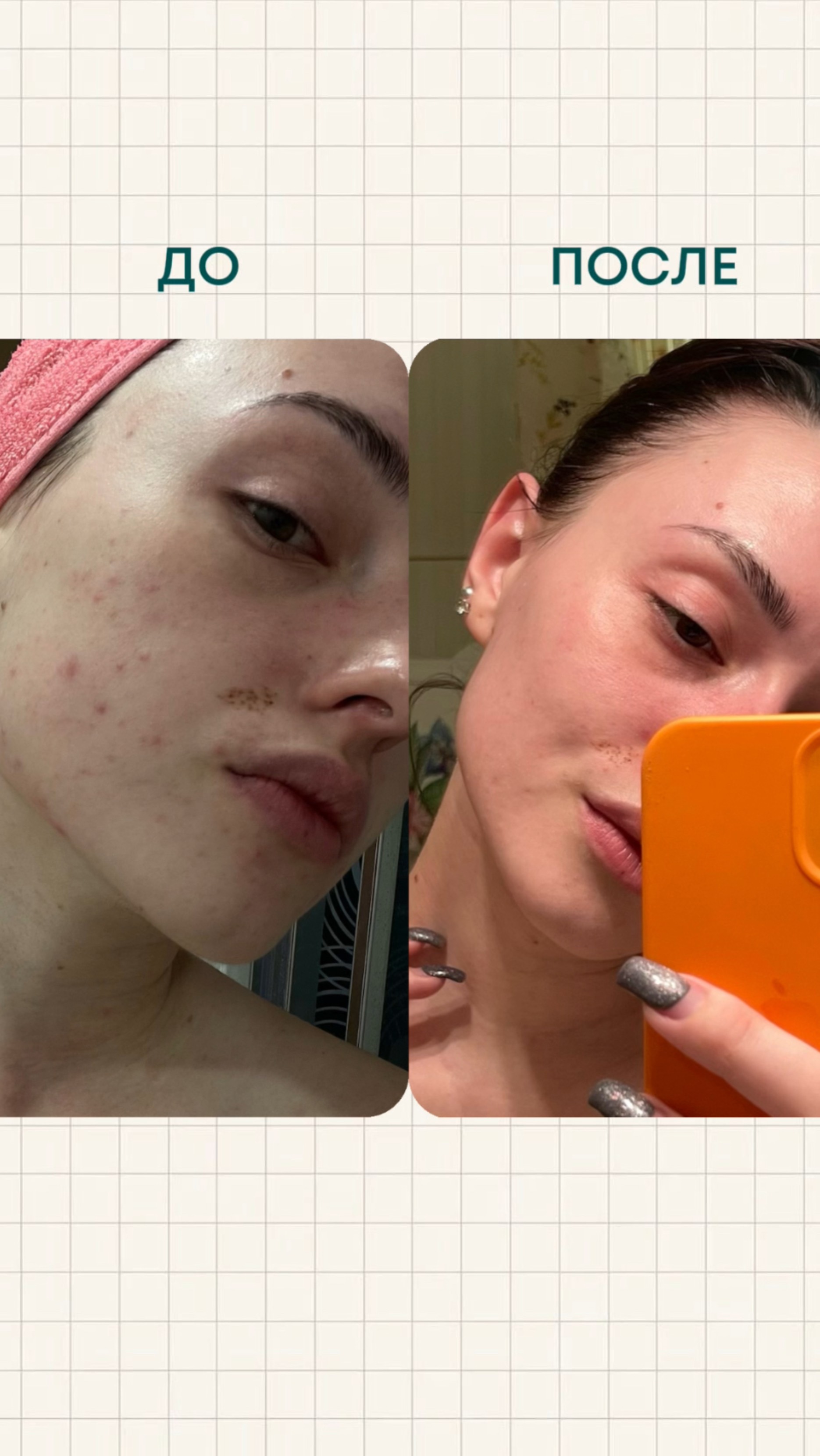 Мой любимый компонент в косметике — ретинол 💛