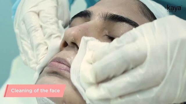 Mango Peel | Chemical Peel | Kaya