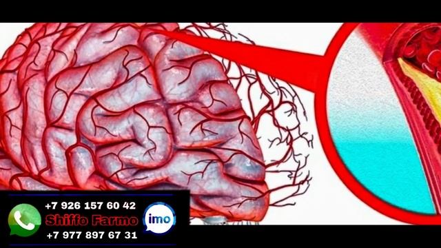 Хӯрдани Клубника Ҷоиз аст / Маълумоти Пура ҳатман бинед