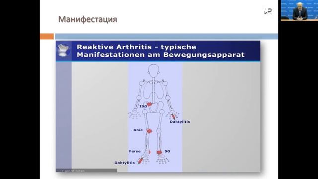 РМАПО  Лила А М   Реактивные артриты