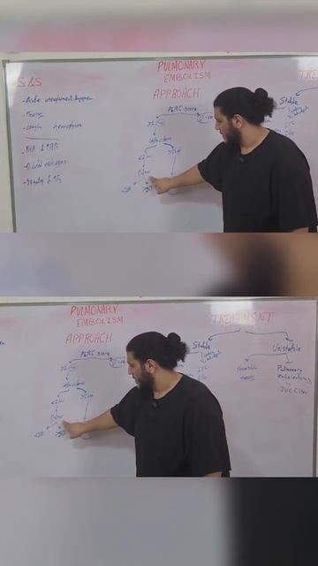 Approach to pulmonary embolism