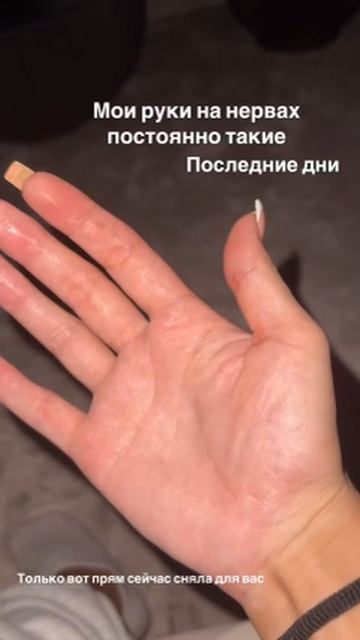 Instagram pinchuk_official stories 3571010683810212882