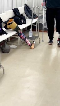 С нами нет ничего невозможного! #shorts #протезирование #мотивация #спорт #реабилитация #футбол