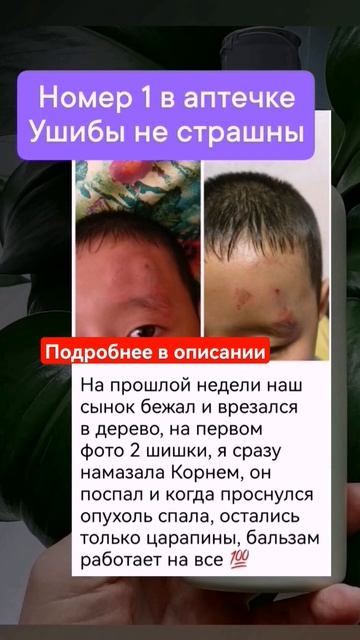 #ушибы #аптечка