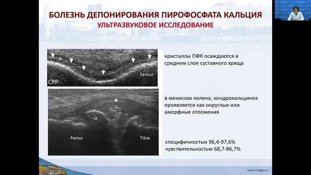 РМАПО  Мезенова Т.В.   Микрокристаллические артриты 2 часть