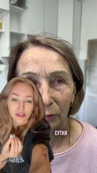 Инверсия на лазере