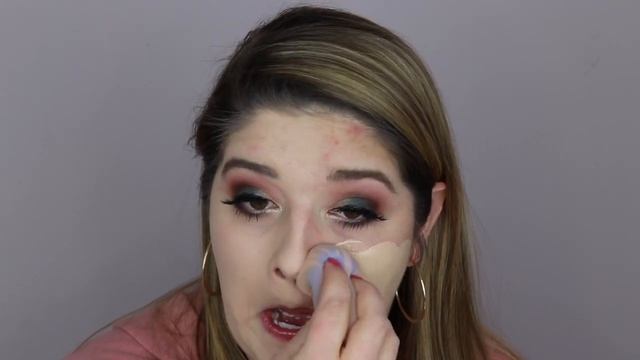 L'OREAL Infallible 24h Foundation | DOES IT COVER ACNE?