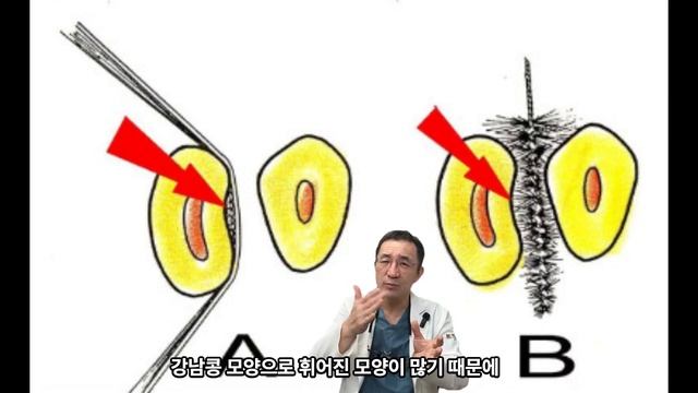 칫솔질의 정석, 치간칫솔 사용법, 올바른 칫솔질 방법 #칫솔질 #칫솔질방법 #치간칫솔 #치실 #치과의사