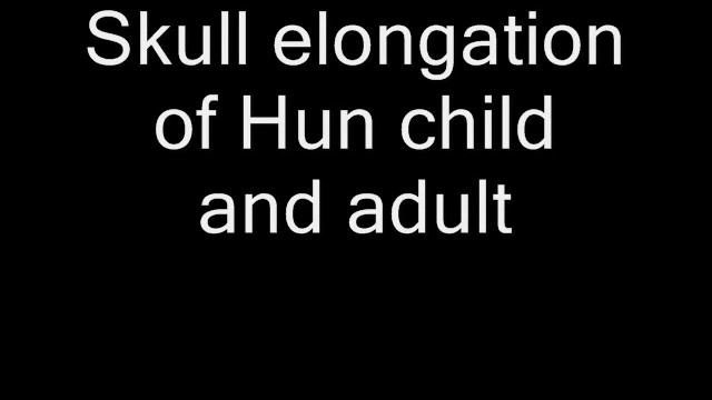 Atilla and Huns were mixed Mongoloid NOT white (according to facial reconstruction)