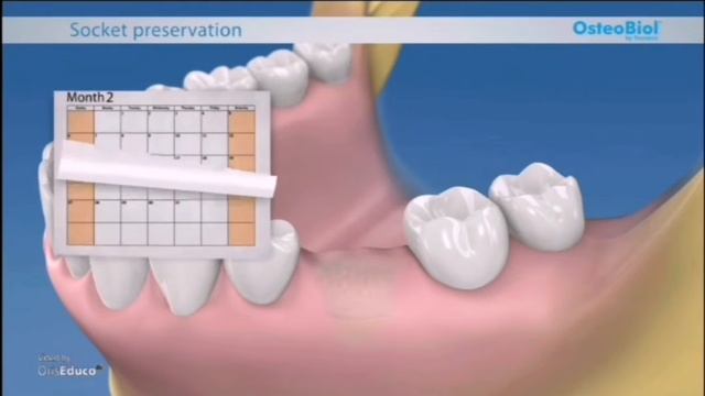 Osteobiol Mp3