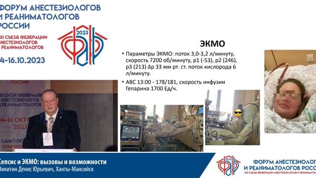 Сепсис и ЭКМО Никитин ДЮ  Съезд ФАРР 2023