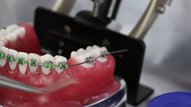 Crimpable Hook in Orthodontics