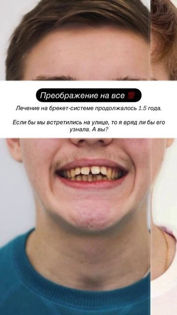 Подпишись ✅
