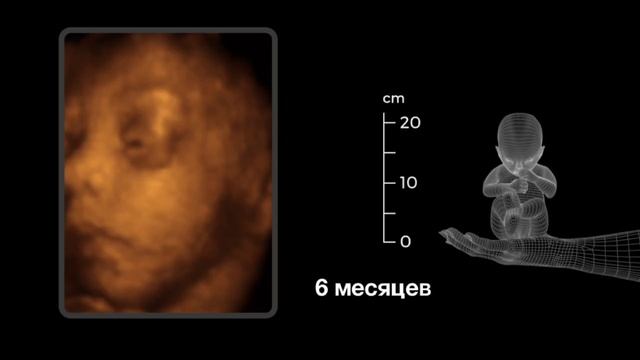 Когда и как начинается жизнь. Научный сотрудник МГУ - А.Молчанов.
