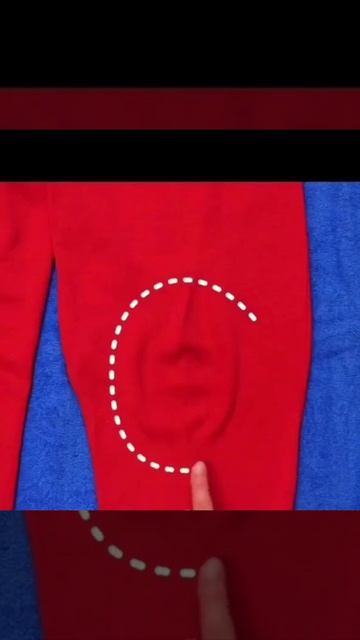 Убираем вытянутые колени👖