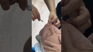 УЦ МЕЛИС контурная пластика