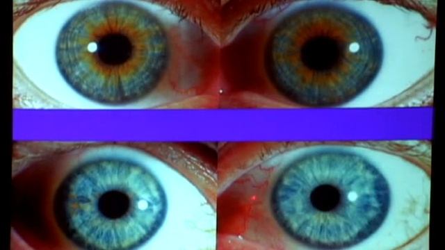 What is Bio Optic Holography?