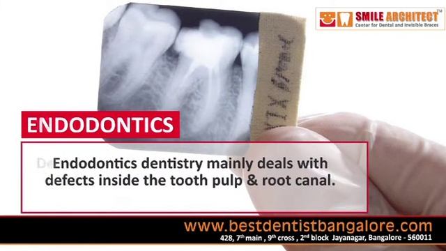 Dental Treatments Bangalore | Root Canal Treatment Karnakata