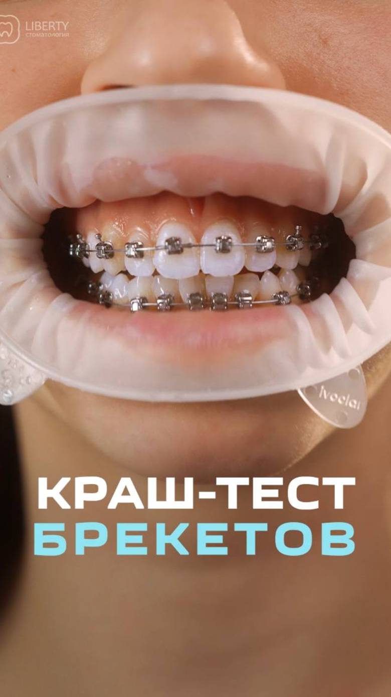 КРАШ-ТЕСТ брекетов!